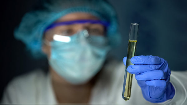 lab worker holding test tube with urine sample, health check, medical analysis