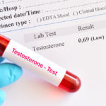 abnormal low testosterone hormone test result